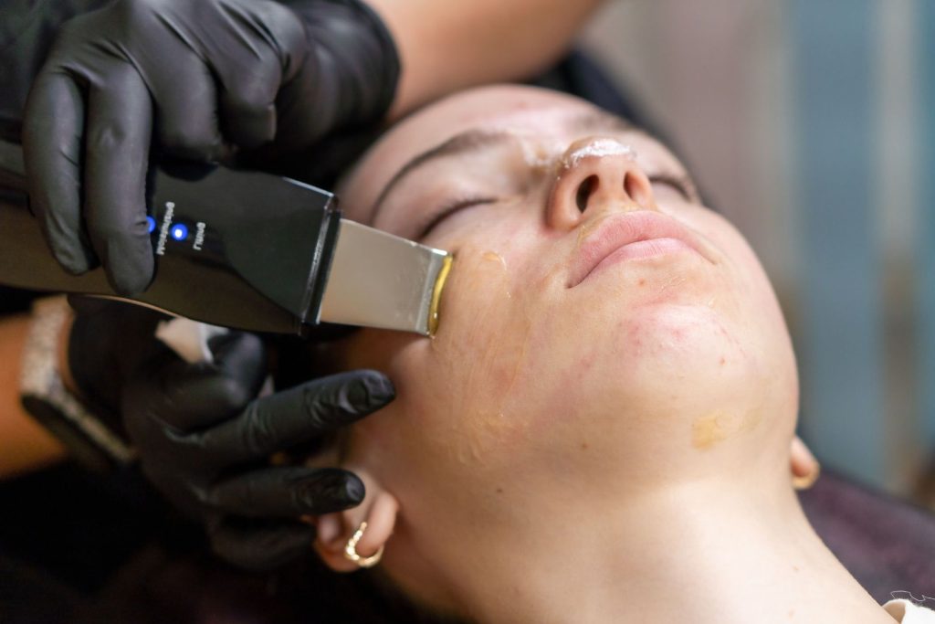A person lying down with their eyes closed is receiving a facial treatment. The technician wearing black gloves uses a handheld ultrasonic device on the person's cheek. The person's face shows redness and some acne, and they have a nose strip applied.