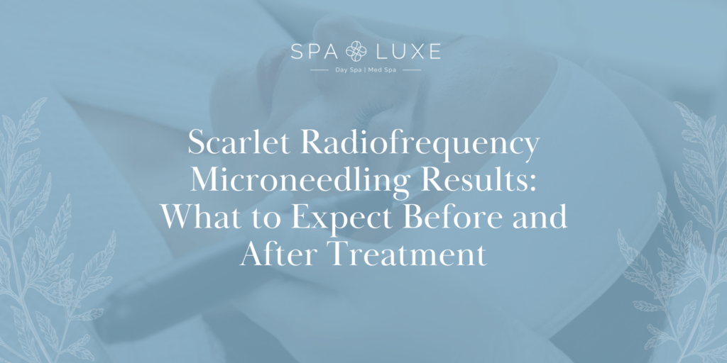 A person receives a facial treatment while lying down, accompanied by text about Scarlet radiofrequency microneedling results at Spa Luxe, describing what to expect before and after treatment.